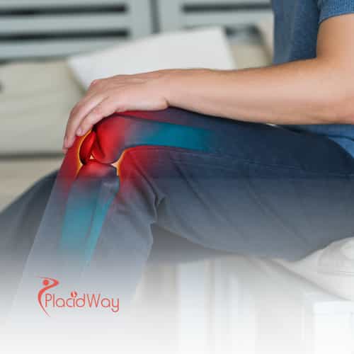 Stem Cell Therapy in Thailand for Osteoarthritis: A Lifesaver for Middle Eastern Patients with Joint Pain